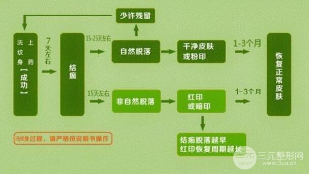 洗紋身事項(xiàng)問(wèn)與答：
