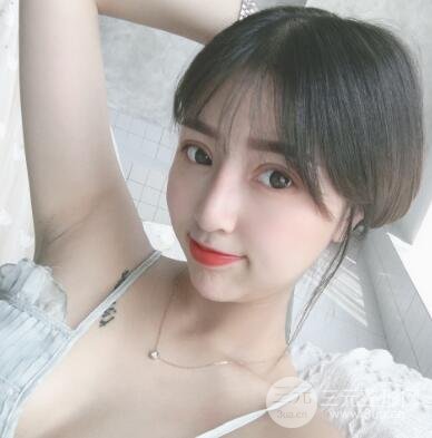 割雙眼皮真人案例