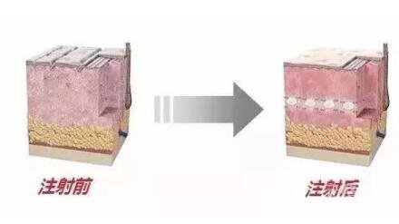 水光補(bǔ)水美容危害