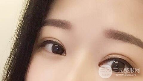 手術(shù)后常見的正常問題