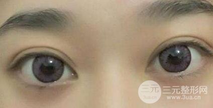 手術(shù)后常見的正常問題