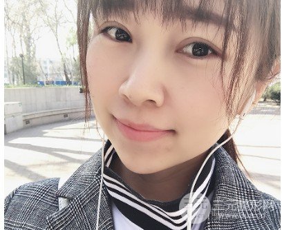 真實(shí)玻尿酸隆下巴日記