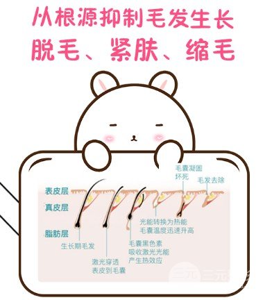 冰點脫毛要幾次才能完全去掉