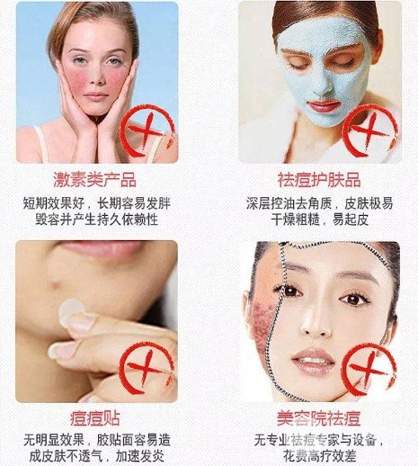 激光緩解痤瘡大概多少錢