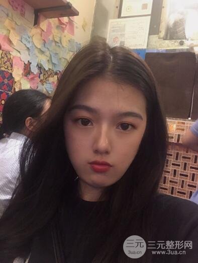 手術(shù)后4~7天