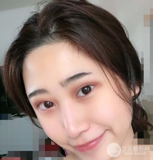 手術(shù)后前三天