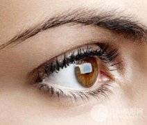 埋線雙眼皮十天恢復(fù)圖真人記錄，埋線雙眼皮手術(shù)科普~