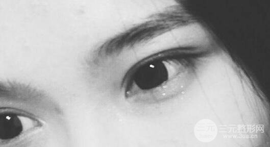 手術(shù)后的護理