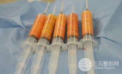 自體脂肪豐胸有哪些比較突出的優(yōu)勢呢?