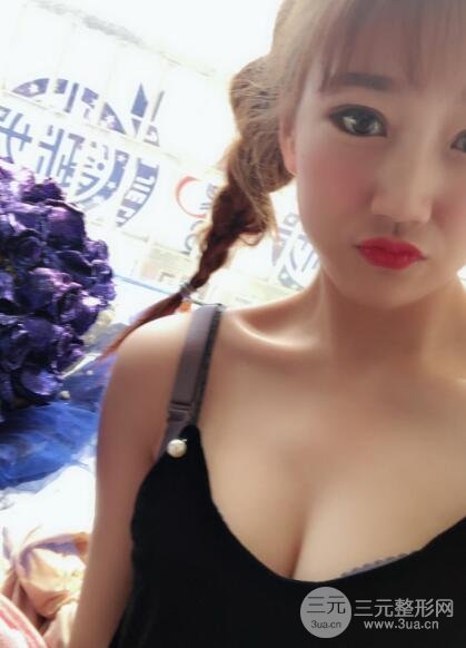 八大處脂肪隆胸案例