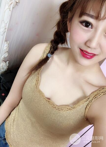 八大處脂肪隆胸案例