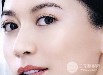 割雙眼皮手術(shù)圖片