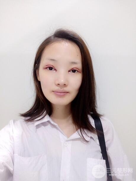 手術(shù)之后的那幾天