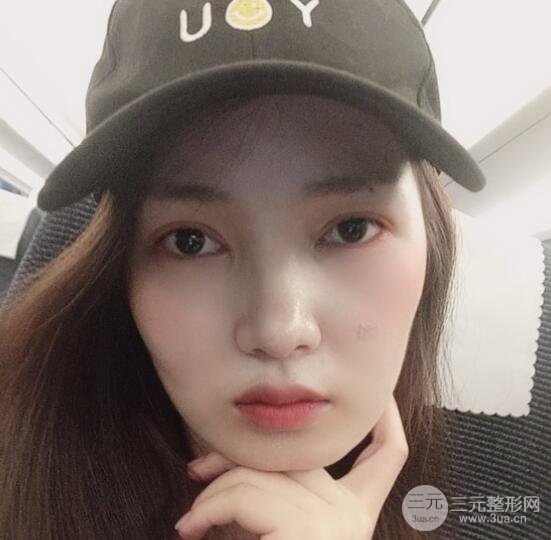 手術(shù)之后的那幾天