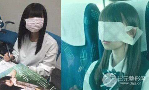 怎樣注射注射瘦臉