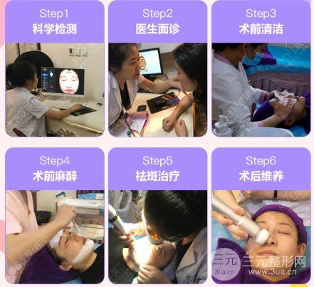 激光可以去除黃褐斑嗎