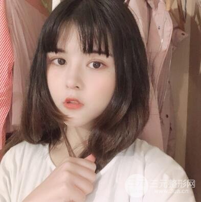 壓雙眼皮后幾天