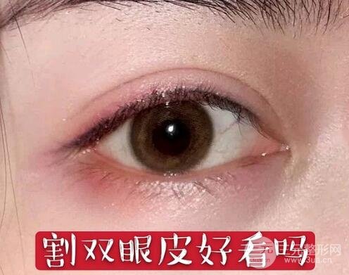 割雙眼皮的風(fēng)險(xiǎn)有哪些?