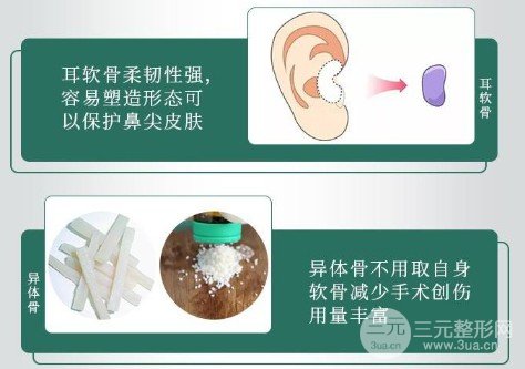 耳軟骨墊鼻尖吸收率很高嗎