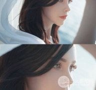 縮鼻翼前后對(duì)比照，鼻子高挺不粗獷的秘密