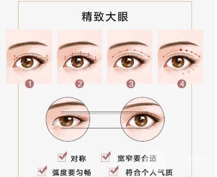 雙眼皮手術(shù)后恢復(fù)期