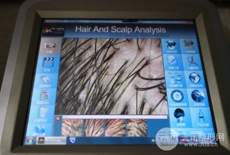 青島植發(fā)價(jià)格表