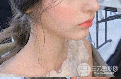 蜂巢激光祛斑果