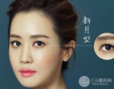 zui好看的四種雙眼皮有哪些？你已擁有嗎？