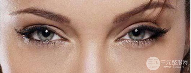 歐式眼睛的人漂亮嗎