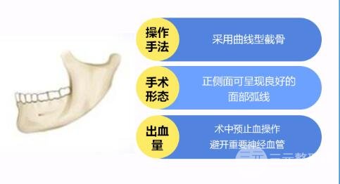 磨下頜角手術價格