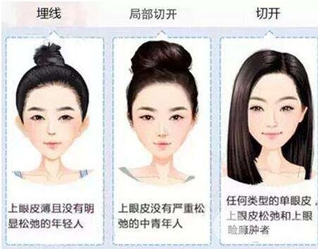 做埋線后老了的危害