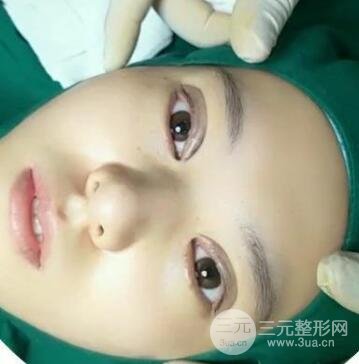 納米微創(chuàng)和全切哪個好