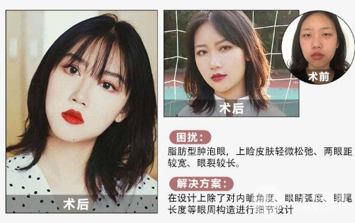 怎樣讓眼睛變大變萌