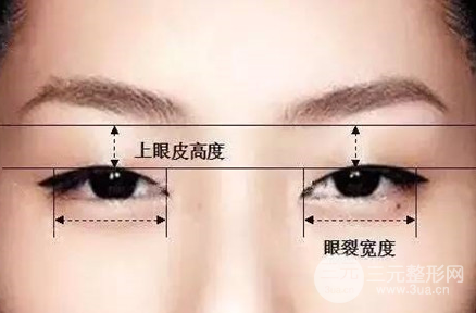 歐式眼與芭比眼的區(qū)別