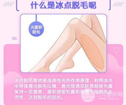 冰點脫毛維持時間