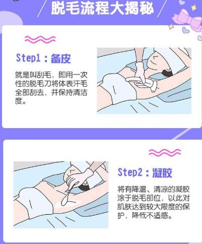 冰點脫毛維持時間