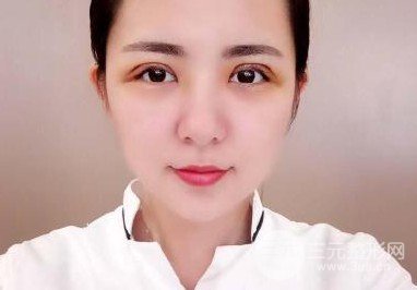 上瞼下垂術(shù)后12天圖片