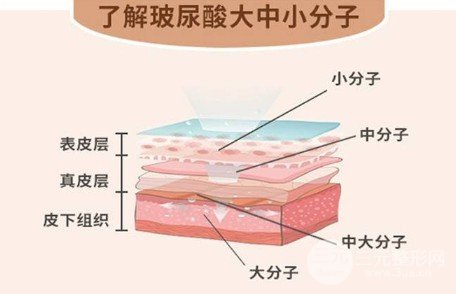 醫(yī)生如何注射玻尿酸