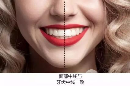 北大口腔醫(yī)院講解牙齒美白