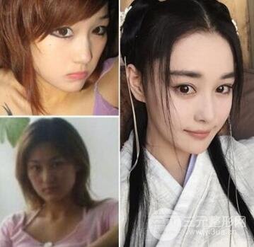張馨予整容前和整容后的照片