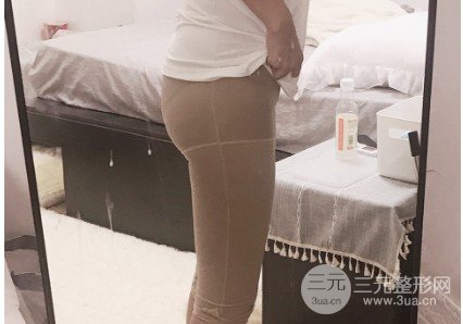 等離子激光溶脂果如何