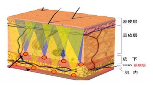 熱瑪吉是什么美容項(xiàng)目