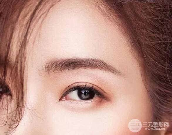 單眼皮整容前后照片真人術(shù)后展示，靈光大眼好吸睛~