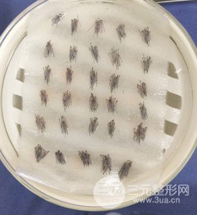 昆明正規(guī)醫(yī)院植發(fā)價(jià)格表