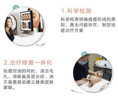 光子緩解痤瘡需要幾次