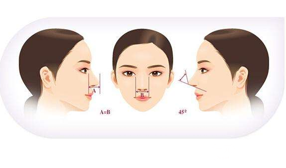 假體隆鼻手術(shù)降低風(fēng)險(xiǎn)嗎