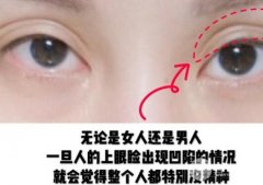 玻尿酸眼窩填充需要幾支？用脂肪填充的果怎么樣？