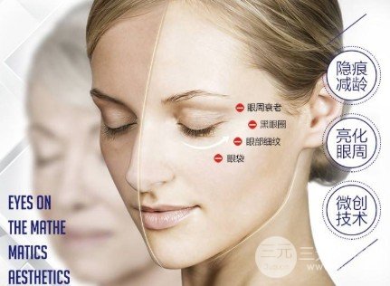 吸脂去眼袋成好嗎