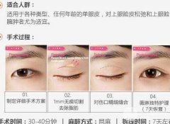 北京割雙眼皮多少錢？影響雙眼皮手術(shù)價(jià)格的因素