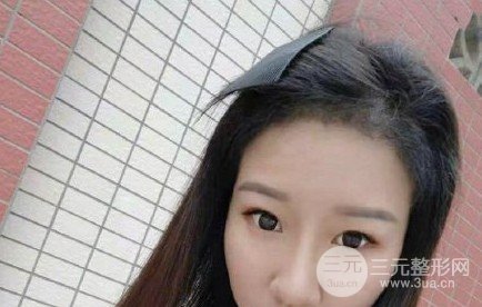 河南植發(fā)正規(guī)醫(yī)院收費(fèi)標(biāo)準(zhǔn)